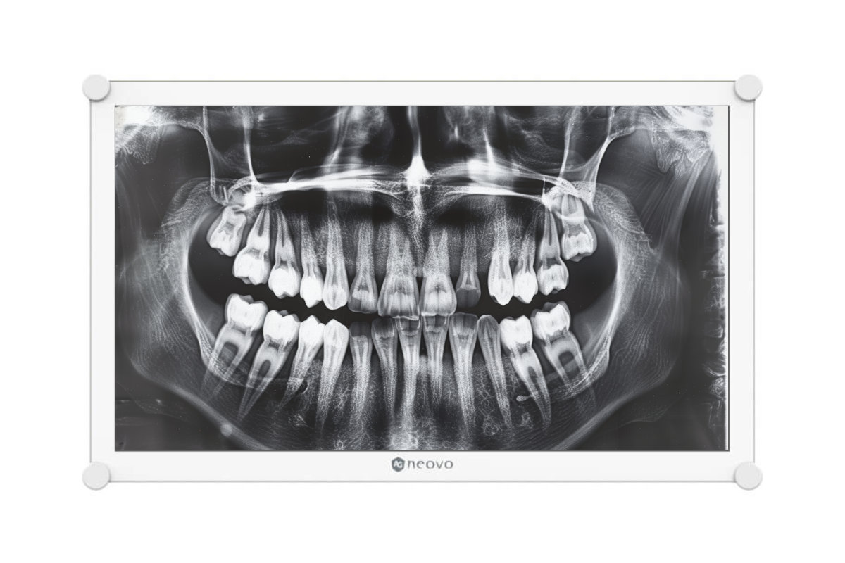 Ag Neovo DR-2022 Medical Display example x-ray