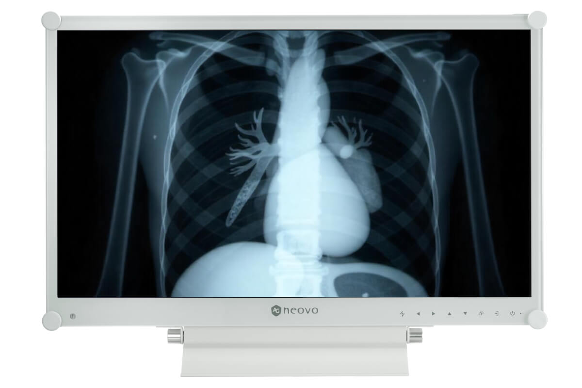 AG Neovo x-ray on display with dicom compliancy for ideal greyscale